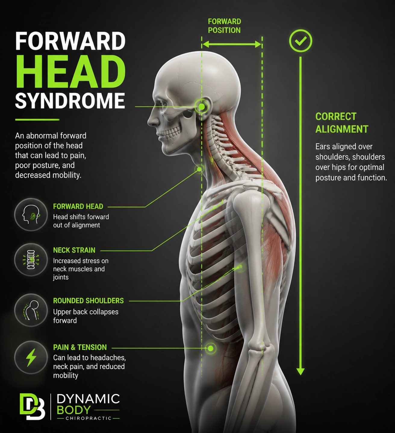 Image showing Forward Head Syndrome